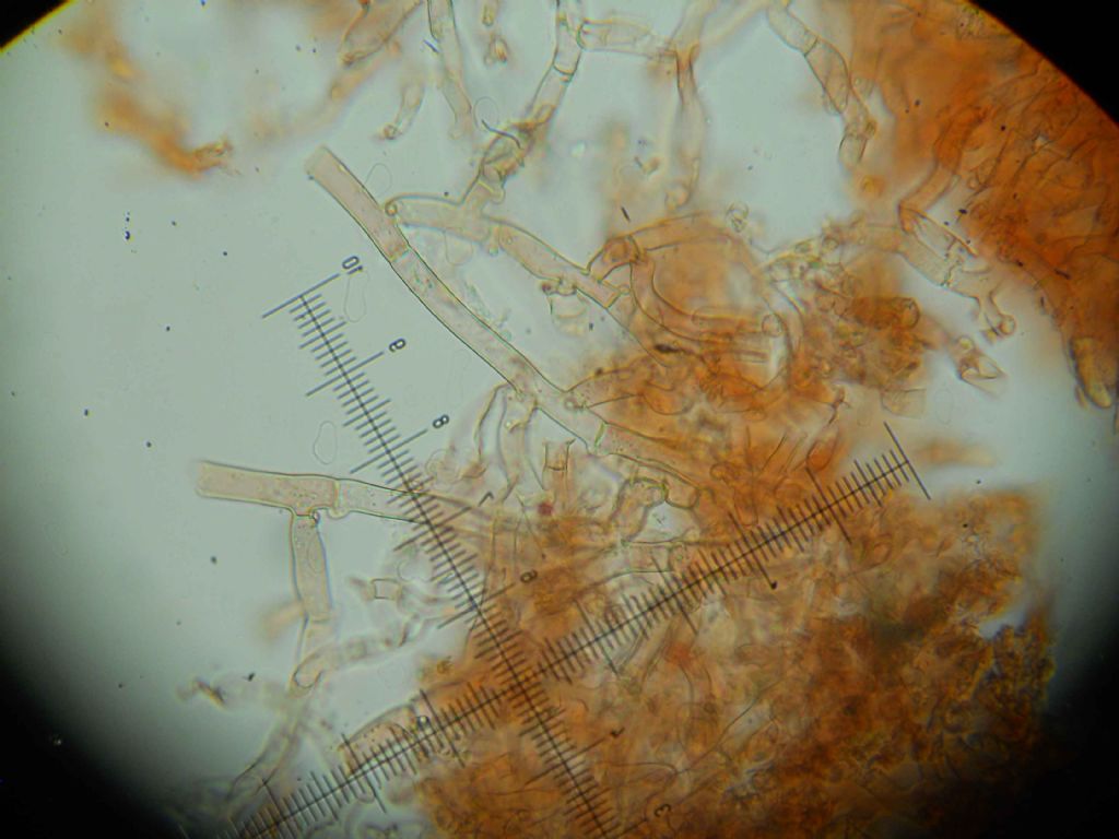 Botryobasidium? (Botryobasidium subcoronatum)